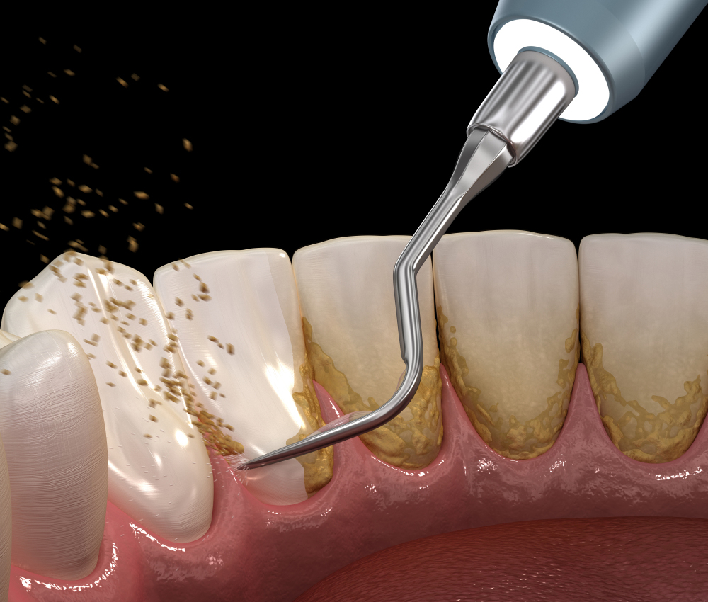 Sunny Family Dental photo 4